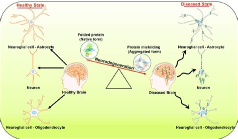 Progression of neurodegenerative diseases. | Download Scientific Diagram