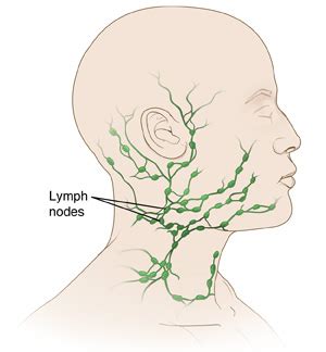 Excisional Biopsi: Nakke Lymph Node | Precision