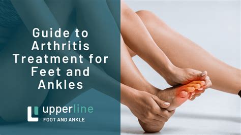 Guide to Arthritis Treatment for Feet and Ankles