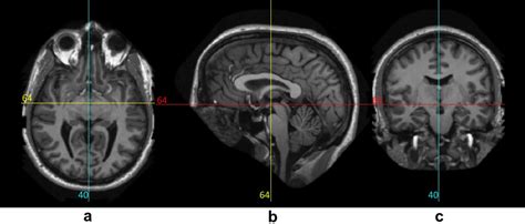 a: Axial view. b:Sagittal view. c:Coronal view of the brain [7 ...