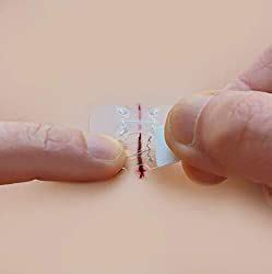 All you need to know about stitching wounds during emergnecy situations ...