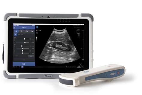 Wireless Portable Ultrasound - Visionflex