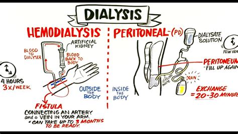 Failing Kidneys and Different Treatment Options - YouTube