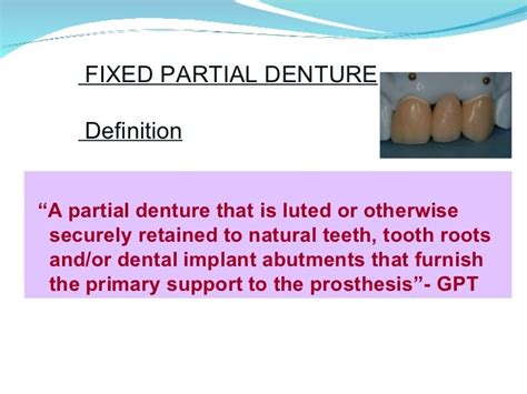 Introduction to fixed partial denture