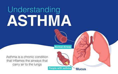 Overview of Asthma: Causes, Symptoms,Types, Risk Factors and its Treatment