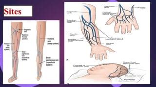 Intravenous Injection Sites