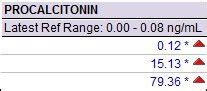 Procalcitonin Inflammatory Biomarker | RK.MD