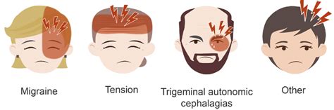 Headache classification • LITFL • Neurology library