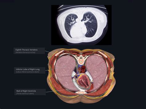 Transverse Section Anatomy