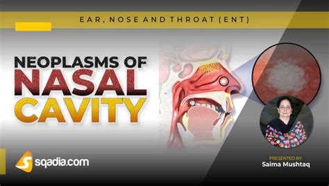 Neoplasms of Nasal Cavity - Introduction