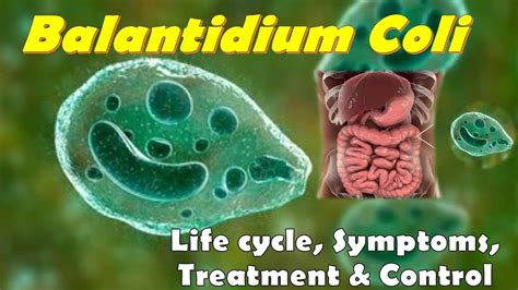 Balantidium coli Morphology Life cycle Symptoms Treatment and Control ...