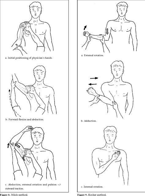 Medicowesome: Reduction Of Anterior Dislocation Of Shoulder, 44% OFF