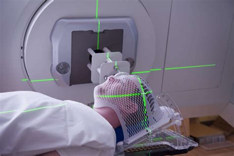 Palliative Radiation Therapy as Treatment for Cancer