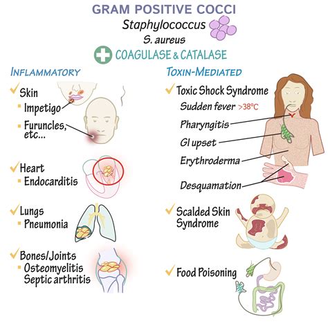 Immunology/Microbiology Glossary: Gram-Positive Cocci - Overview | Draw ...