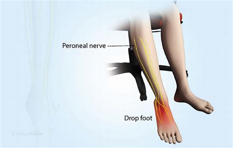 Health Condition : Symptoms, Causes, Treatment and More