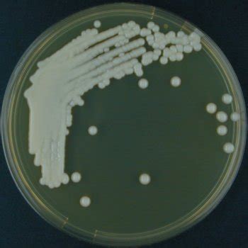 Cryptococcus neoformans