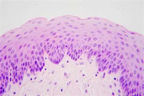 Stratified Squamous Epithelium Non Keratinized Esophagus Histology My ...