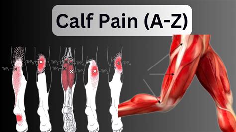 Don't Ignore Calf Pain View: Causes, Symptoms & Best Treatment