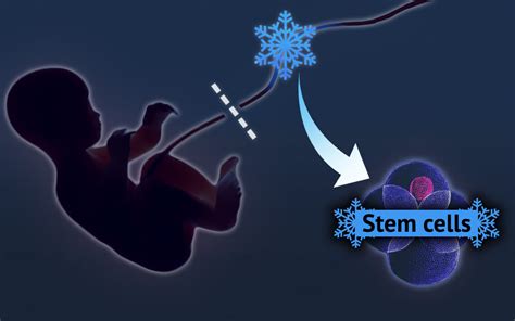 Cord Blood Vs Stem Cells - Umbilical Cord Stem Cells Current Uses ...