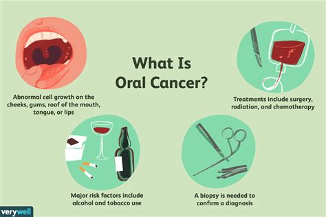 ¿Qué es el cáncer oral? - Medicina Básica