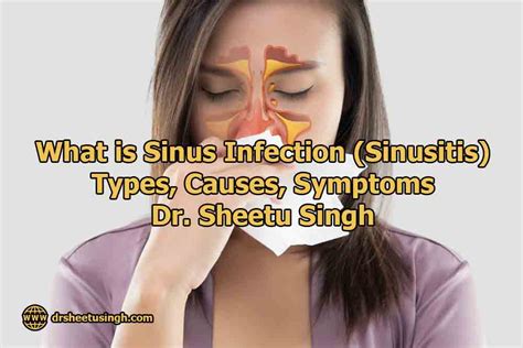 Sinus Infection (Sinusitis)? Types, Causes, Symptom & Treatment