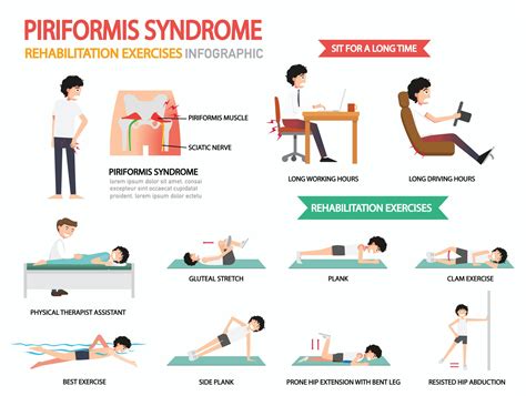 piriformis syndroom revalidatie oefeningen infographic 3239840 ...