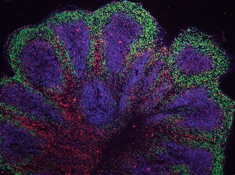 Mini-Brains for Disease Research | Science-Based Medicine