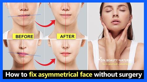 3 Steps Fix Asymmetrical Face | Fix uneven lips, uneven cheeks, uneven ...