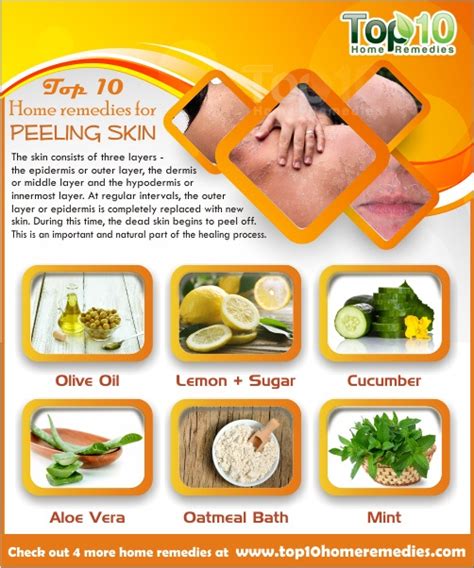 Home Remedies for Peeling Skin | Top 10 Home Remedies