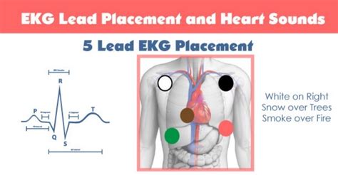 5 Lead EKG Placementjpg_Page1 - Copy - NCLEX Quiz