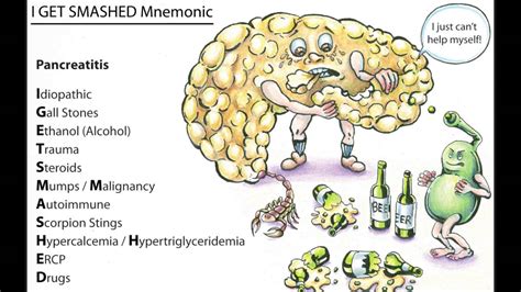 Pancreatitis Mnemonic - YouTube