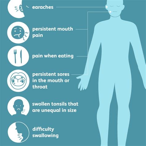 Tonsil Cancer Vs Tonsil Stones - CancerWalls