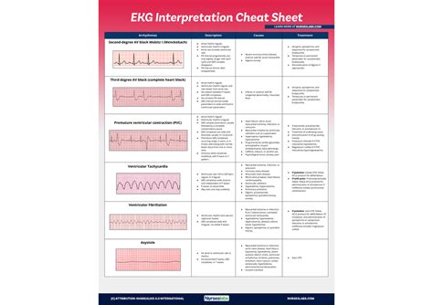 EKG-Interpretation-Cheat-Sheet-for-Heart-Arrhythmias Nurseslabs 3 - EKG ...