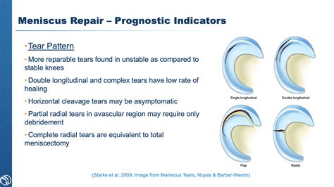 3 Types of Meniscus Tear Treatment | Knee Specialist | Baton Rouge, LA