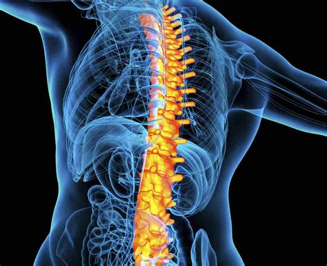 Compression Fracture from Car Accident - Fractured Vertebrae Car Accident