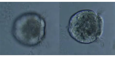 How to Focus a Microscope – Microscope Clarity