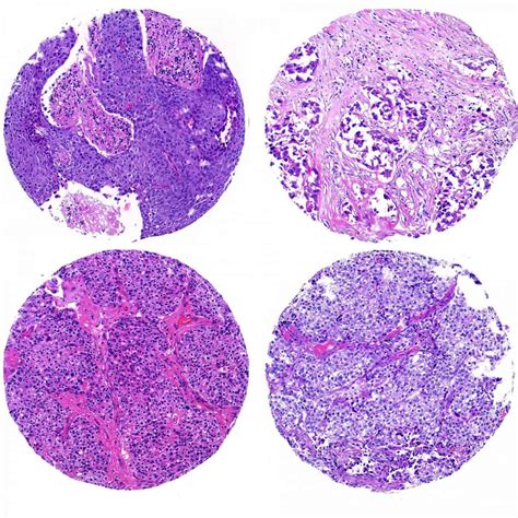 Control Slides, Tissue Microarray, Normal Human Tissue, 4 Tissue Types ...