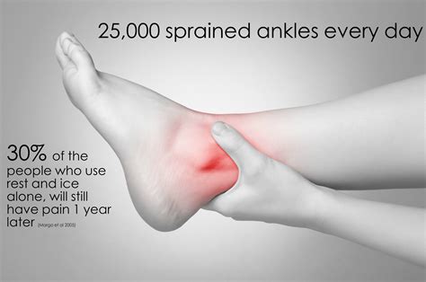 Sprained ankle explained