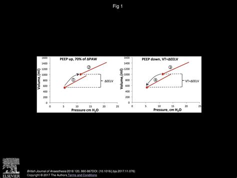 P. Persson, O. Stenqvist, S. Lundin British Journal of Anaesthesia ...