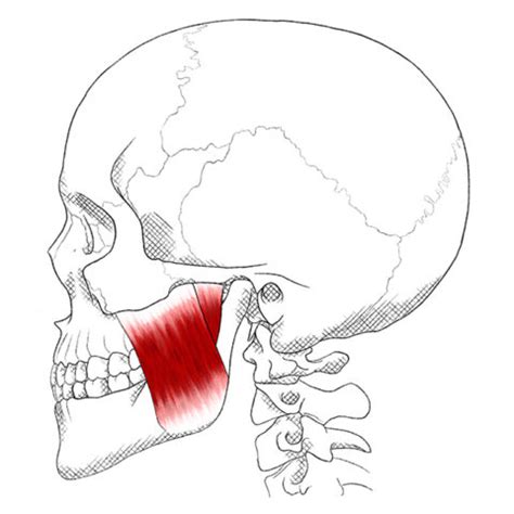 Músculo masetero – Dolor y puntos gatillo