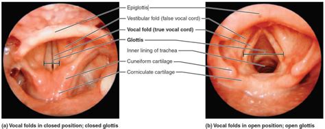 Epiglottis anatomy, location, function and epiglottis infection