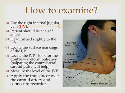 PPT - Jugular Venous Pulse and Carotid Arterial Pulse PowerPoint ...