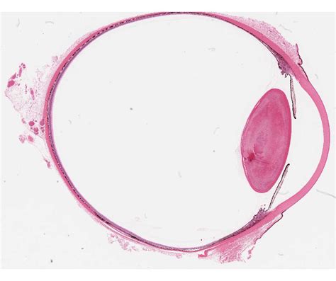 Lens Histology