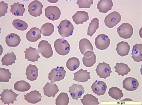 Plasmodium falciparum