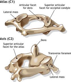 Cervical (C1-C2) Fracture - Sports Medicine I : 2012-2013