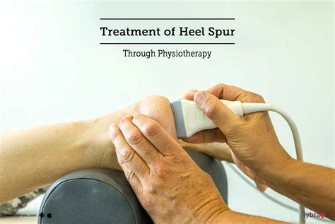 Treatment of Heel Spur Through Physiotherapy - By Dr. Vishwas Virmani ...