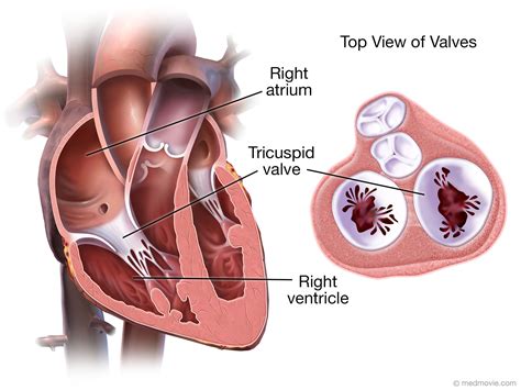 Medmovie.com | Tricuspid Valve