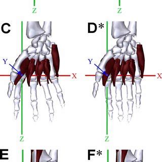 Six movements of the wrist joint (condyloid type) (A-C, lateral view ...