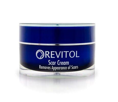 Removal of Keloid Scars Using Scar Cream | by Burn Scar | Medium