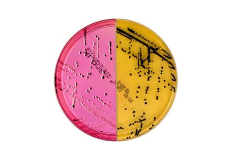 Thermo Scientific Salmonella Shigella Agar (SS Agar) / XLD Agar Biplate ...